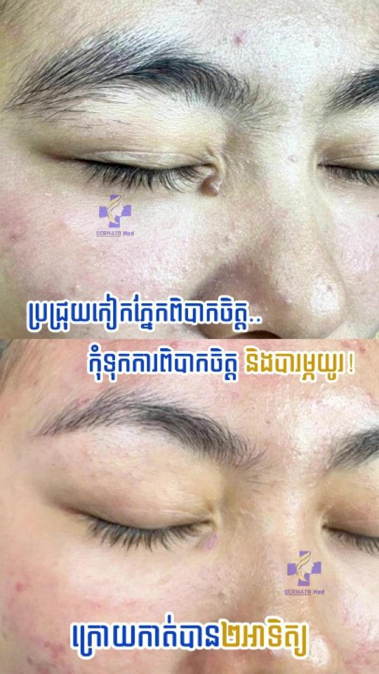 TikTok video thumbnail by dermato_med