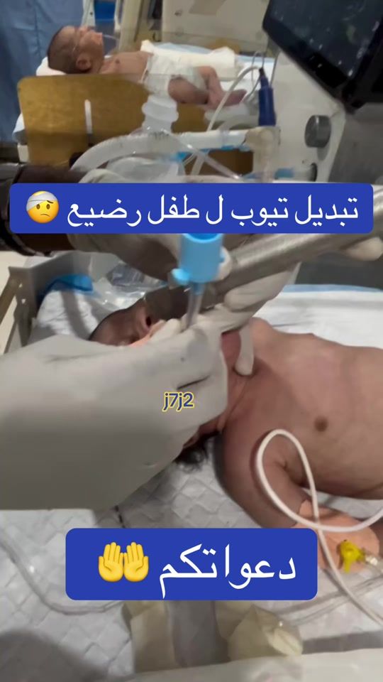 TikTok video thumbnail by j7j2
