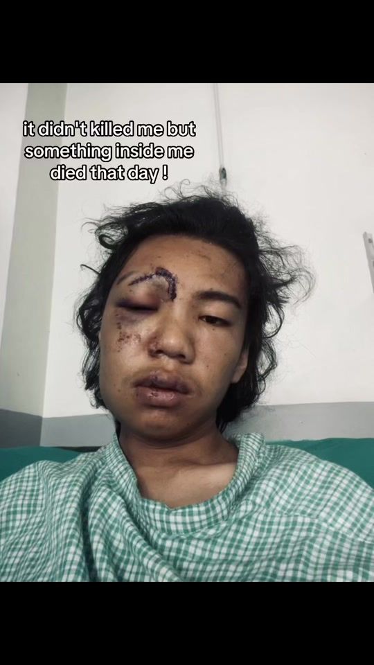 TikTok video thumbnail by limbu_sasii