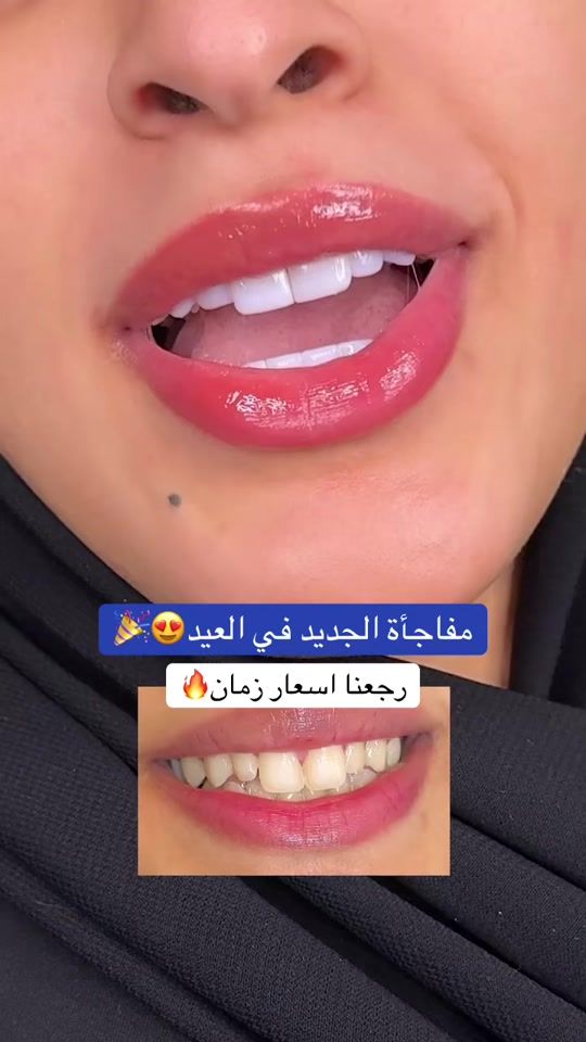 TikTok video thumbnail by albaclinics