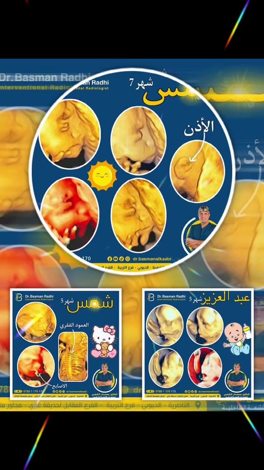 TikTok video thumbnail by dr.basmanalkaabi