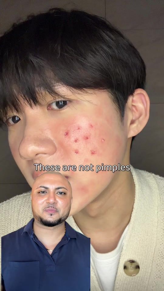TikTok video thumbnail by irafluence