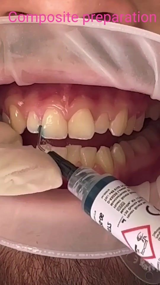 TikTok video thumbnail by dr_shakeel_s_a