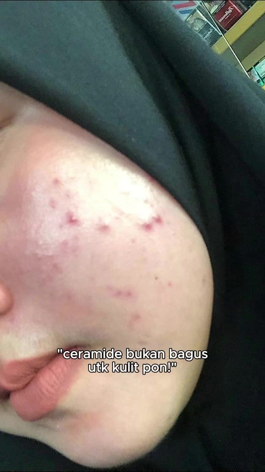 TikTok video thumbnail by syazsuanuwar