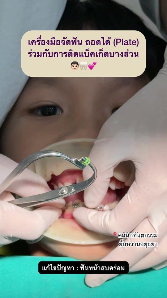 TikTok video thumbnail by yimwhanclinic_ayutthaya