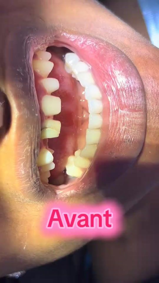 TikTok video thumbnail by dentistessud