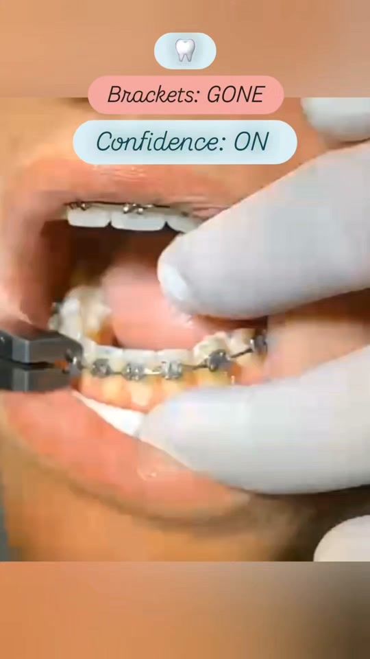 TikTok video thumbnail by dr.roger.dentist