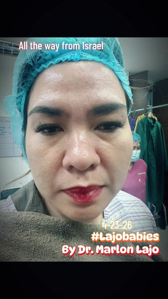 TikTok video thumbnail by lajo_md
