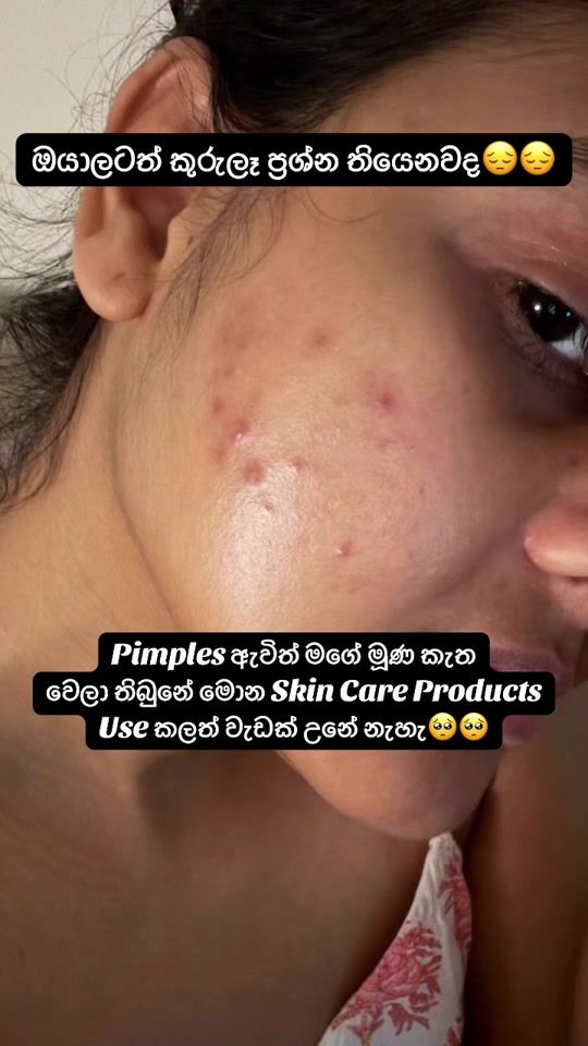 TikTok video thumbnail by ayurakanti_cream