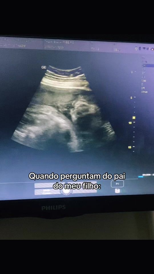 TikTok video thumbnail by taliaribeiro2