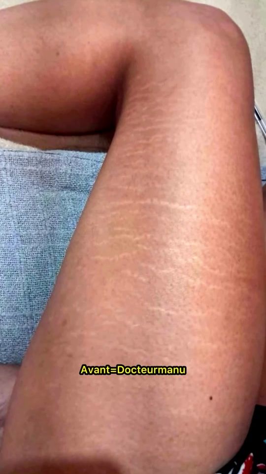 TikTok video thumbnail by pharma..peau