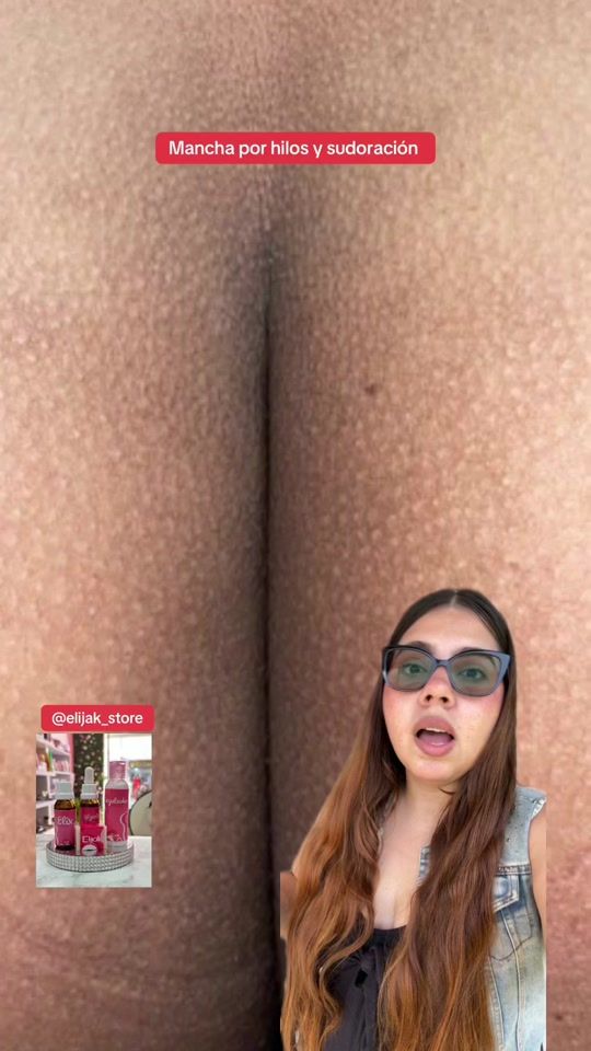 TikTok video thumbnail by elijak_store