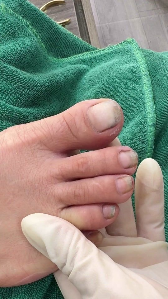 TikTok video thumbnail by 1988_hangnail