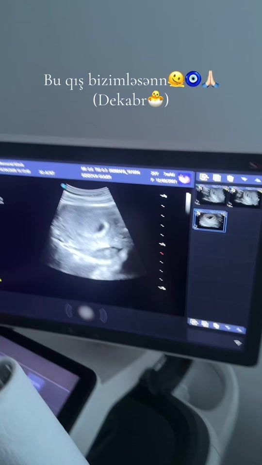 TikTok video thumbnail by aliyeffaa_g