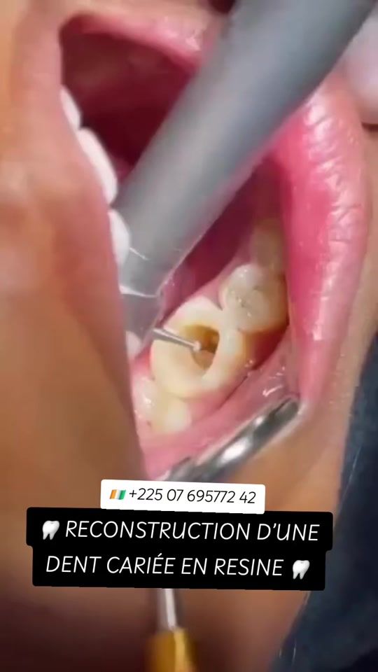 TikTok video thumbnail by a.u.t.o.ri.t.e.den