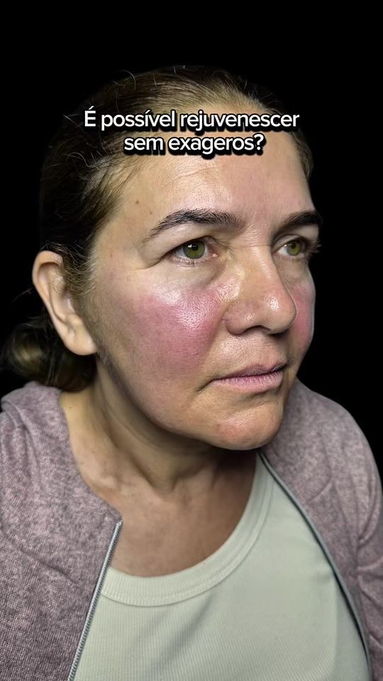 TikTok video thumbnail by dr.luisangel