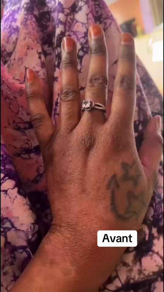TikTok video thumbnail by glow_skin3