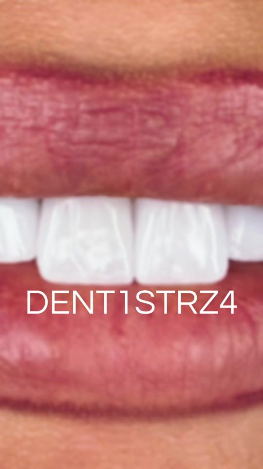 TikTok video thumbnail by dentistrza