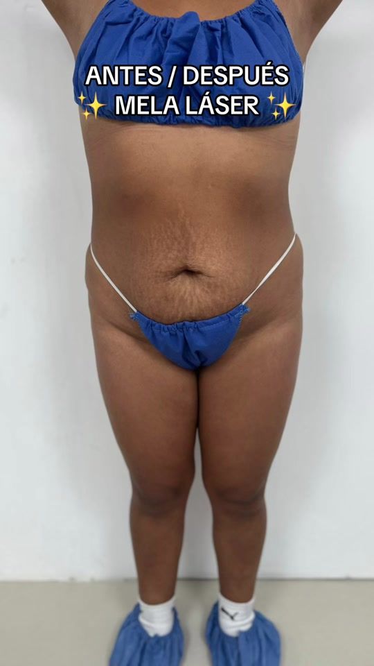 TikTok video thumbnail by bodybeauio