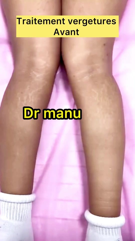 TikTok video thumbnail by pharma..peau