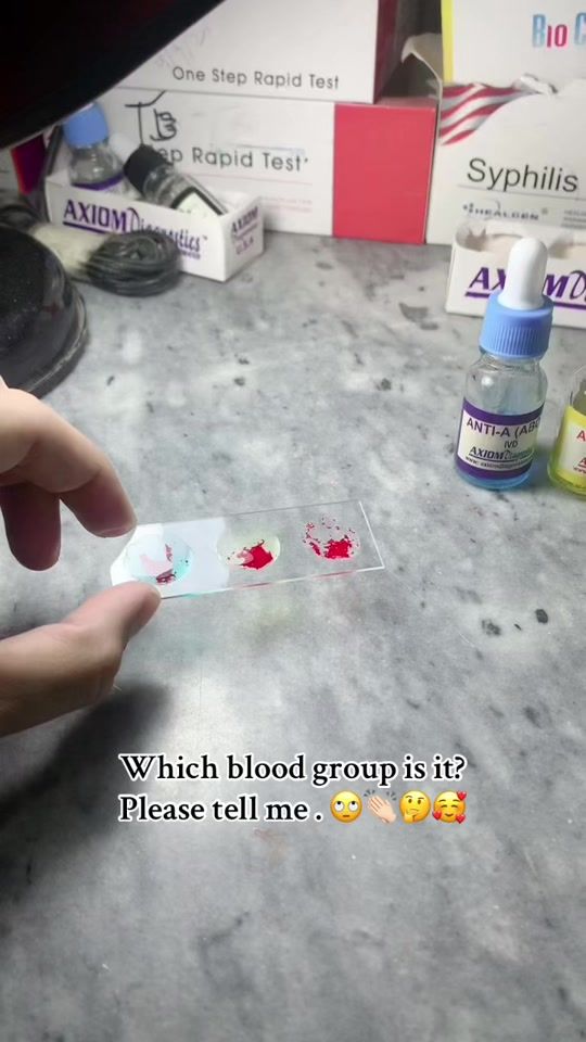 TikTok video thumbnail by dr..sohail.khan