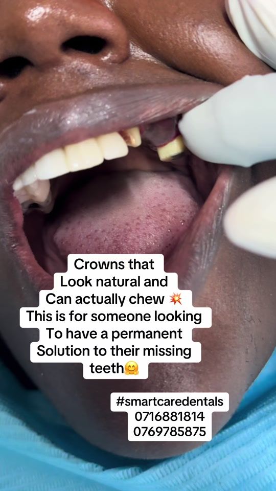 TikTok video thumbnail by smartcaredentalsnairobi