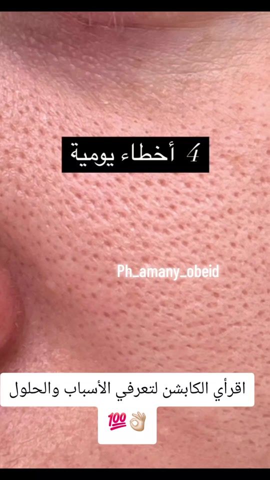 TikTok video thumbnail by ph_amany_obeid1