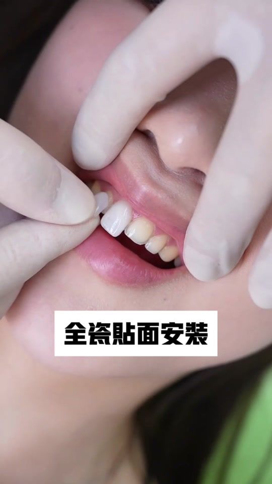 TikTok video thumbnail by 689tooth