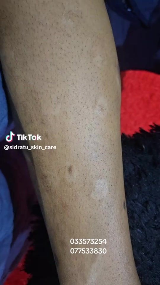 TikTok video thumbnail by sidratuceobaby