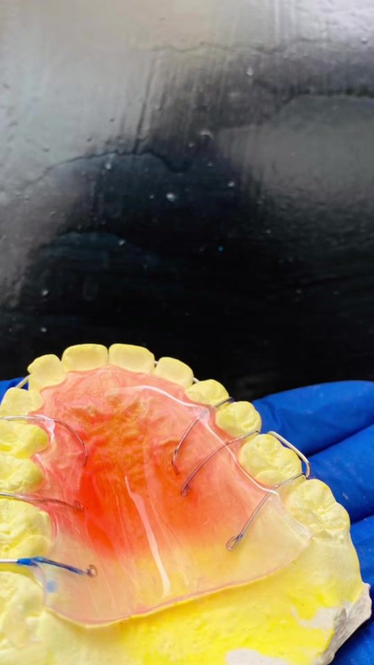 TikTok video thumbnail by dentaltech4