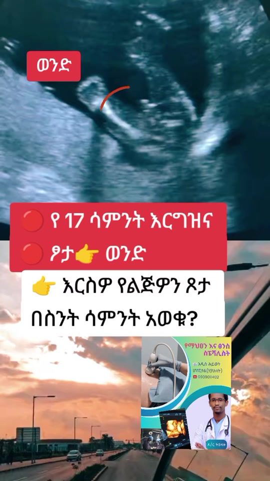 TikTok video thumbnail by dr.tizazu