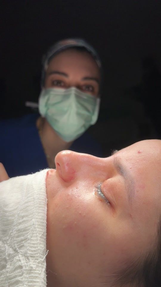 TikTok video thumbnail by dr.ferda.erol
