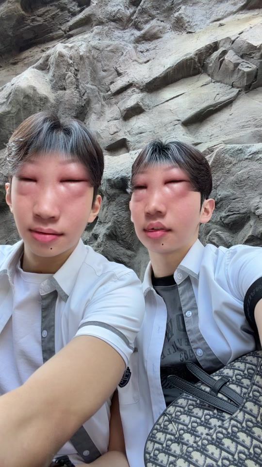 TikTok video thumbnail by pig_subi