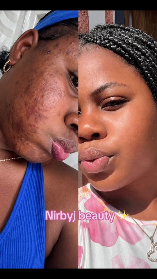 TikTok video thumbnail by nirbyj_beauty8