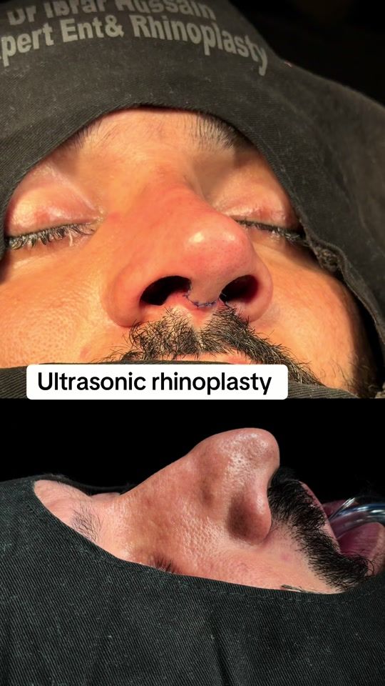TikTok video thumbnail by ibrar_ent