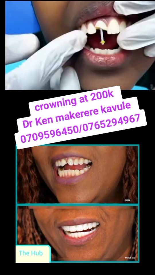 TikTok video thumbnail by kenny25dr