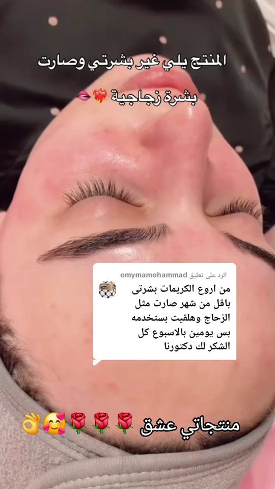TikTok video thumbnail by d.fedaa.abo.elian