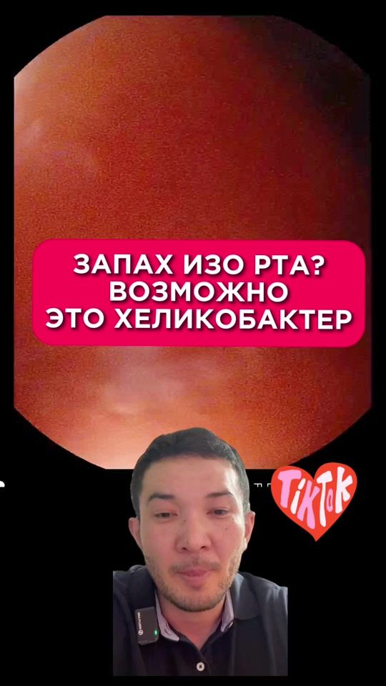 TikTok video thumbnail by almaty_endoscopy