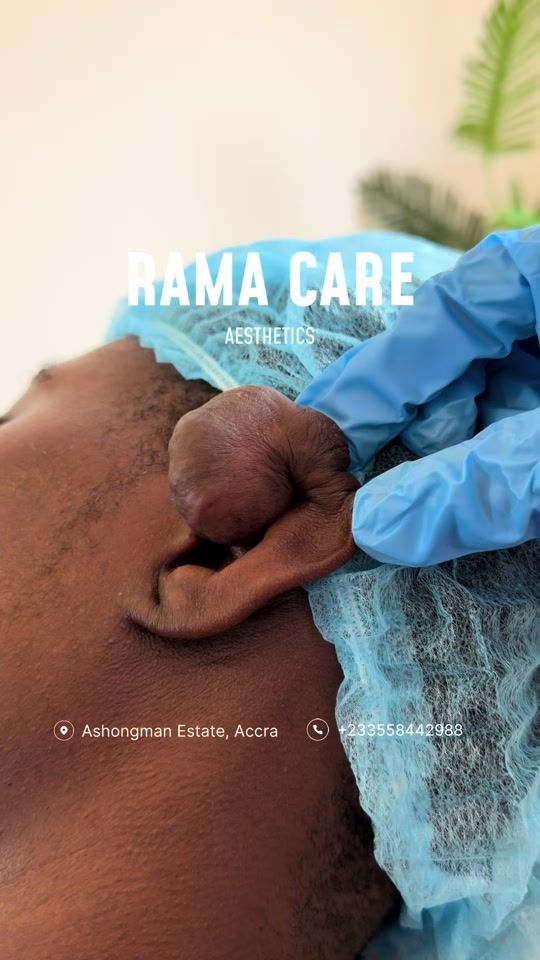 TikTok video thumbnail by rama.care.aesthetics