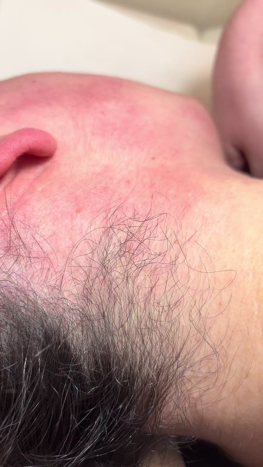 TikTok video thumbnail by electricepilation