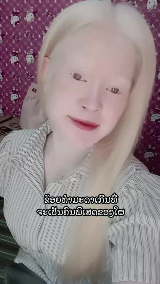 TikTok video thumbnail by peng.sone