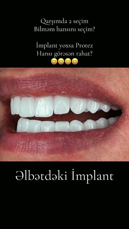TikTok video thumbnail by dentistrza
