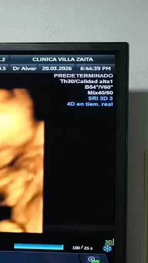 TikTok video thumbnail by linyandi11