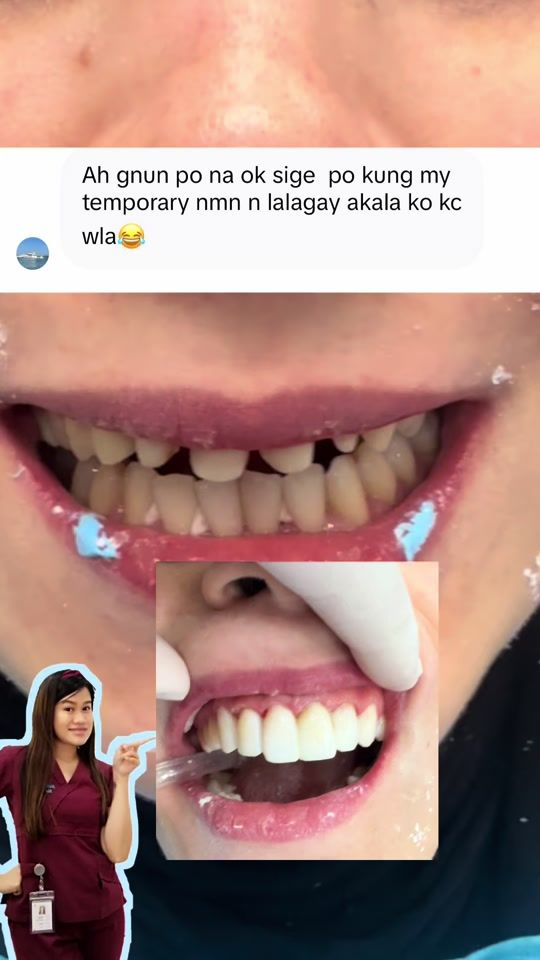 TikTok video thumbnail by nars_lanlan