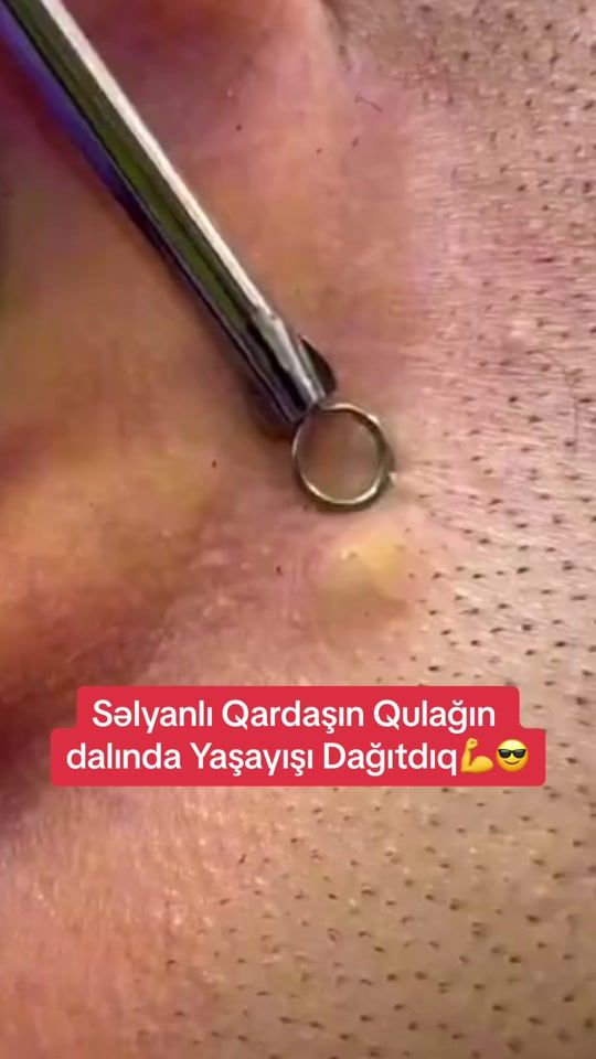 TikTok video thumbnail by dr.nicathuseyn