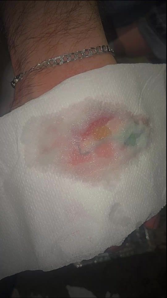 TikTok video thumbnail by tarribon1