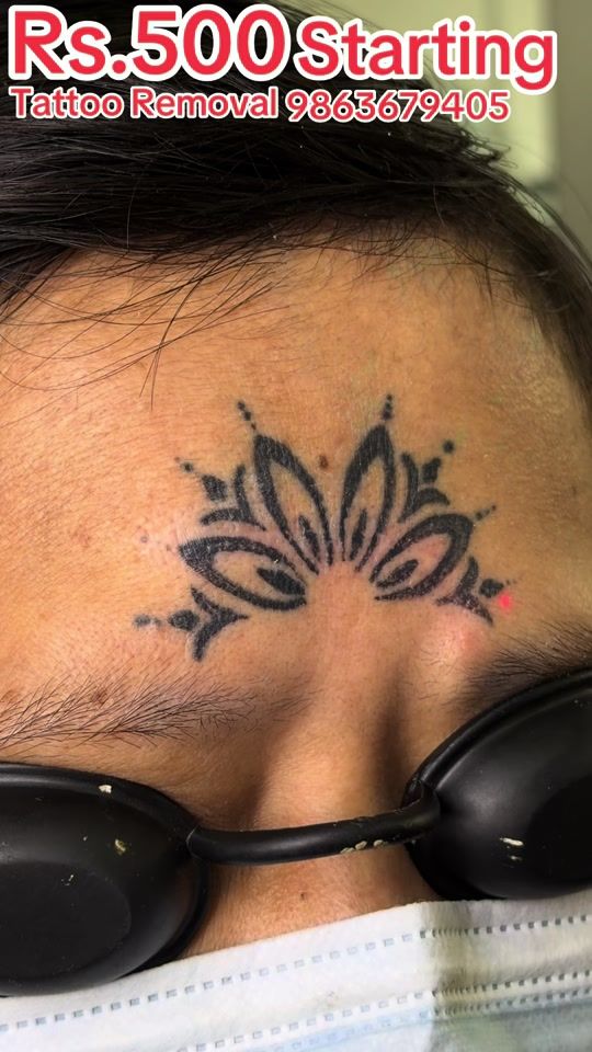 TikTok video thumbnail by drtattoo0