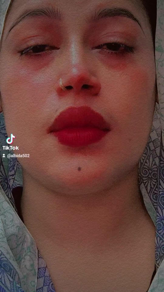 TikTok video thumbnail by albida502