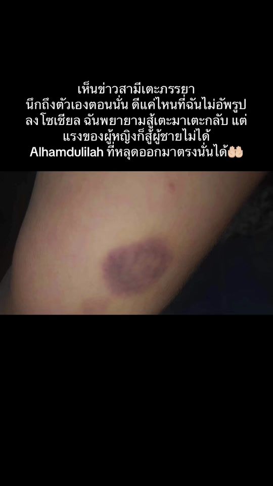 TikTok video thumbnail by awatif1998