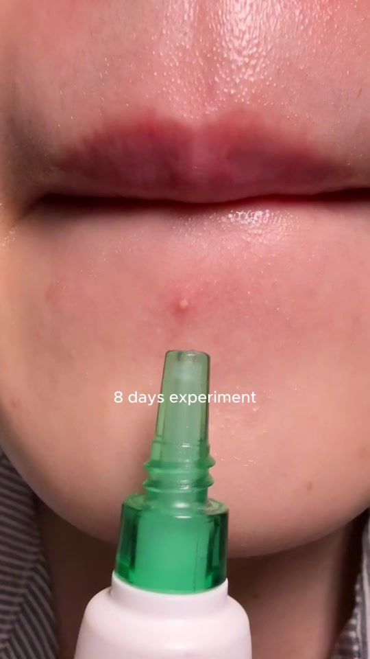 TikTok video thumbnail by leeskincare7